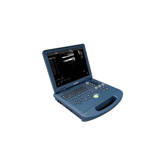 全数字彩色多普勒超声诊断仪 DW-PF520